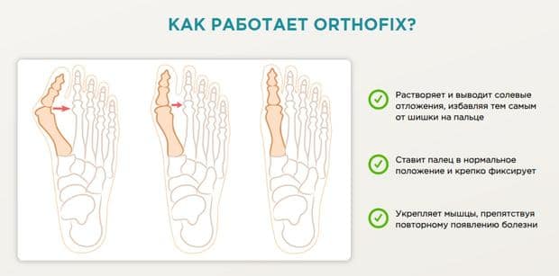 Orthofix қалай жұмыс істейді